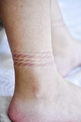 Her ankle