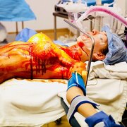 surgerypatient
