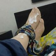Hinafeet